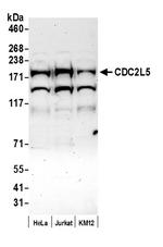 CDC2L5 Polyclonal Antibody