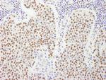 FIP1 Polyclonal Antibody