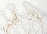 PABP4 Antibody in Immunohistochemistry (Paraffin) (IHC (P))