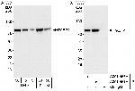 PABP4 Antibody in Western Blot (WB)