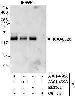 KIAA0528 Polyclonal Antibody