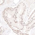 NP95/UHRF1 Polyclonal Antibody