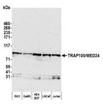 TRAP100/MED24 Polyclonal Antibody