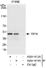TIPIN Polyclonal Antibody