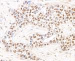 JHDM1A Polyclonal Antibody