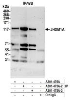 JHDM1A Antibody in Immunoprecipitation (IP)