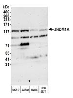 JHDM1A Antibody in Western Blot (WB)