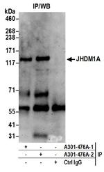 JHDM1A Antibody in Immunoprecipitation (IP)