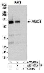JMJD2B Polyclonal Antibody