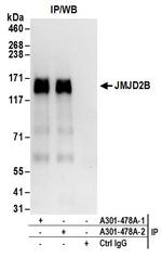 JMJD2B Antibody in Immunoprecipitation (IP)