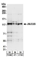 JMJD2B Antibody in Western Blot (WB)