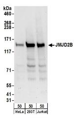 JMJD2B Polyclonal Antibody