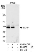 ILKAP Antibody in Immunoprecipitation (IP)