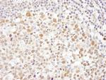Caf1p150 Polyclonal Antibody