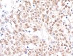 Caf1p150 Polyclonal Antibody