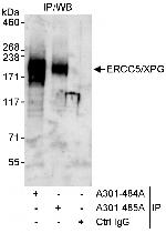 ERCC5/XPG Polyclonal Antibody