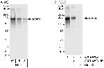 MAP4 Polyclonal Antibody