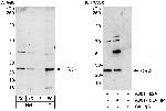 ORC6 Polyclonal Antibody