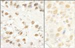 CROP/Luc7A Polyclonal Antibody
