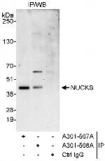NUCKS Antibody in Immunoprecipitation (IP)