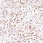 NUCKS Polyclonal Antibody