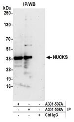 NUCKS Antibody in Immunoprecipitation (IP)