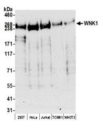 WNK1 Polyclonal Antibody