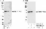 SART3/TIP110 Polyclonal Antibody