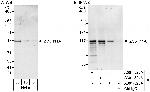 ZC3H11A Polyclonal Antibody