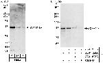 ZC3H11A Antibody in Western Blot (WB)