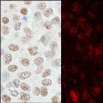 ZNF295 Polyclonal Antibody