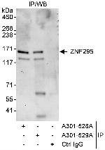 ZNF295 Antibody in Immunoprecipitation (IP)