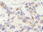 ZNF592 Antibody in Immunohistochemistry (Paraffin) (IHC (P))