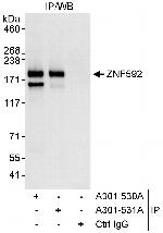 ZNF592 Antibody in Immunoprecipitation (IP)