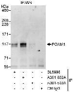 FOXM1 Polyclonal Antibody