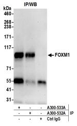 FOXM1 Antibody in Immunoprecipitation (IP)
