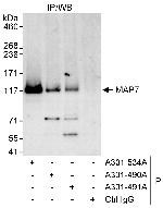 MAP7 Antibody in Immunoprecipitation (IP)