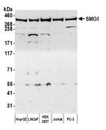 SMG1 Polyclonal Antibody