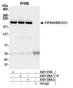 FIP200/RB1CC1 Antibody in Immunoprecipitation (IP)