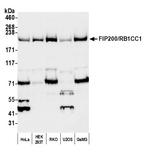 FIP200/RB1CC1 Polyclonal Antibody