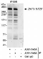 ZNF318/TZF Antibody in Immunoprecipitation (IP)
