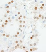 ZNF318/TZF Polyclonal Antibody