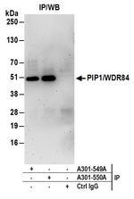 PIP1/WDR84 Antibody in Immunoprecipitation (IP)