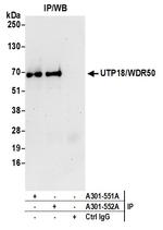 UTP18/WDR50 Polyclonal Antibody