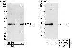 WDR4 Polyclonal Antibody