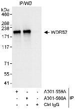 WDR62 Polyclonal Antibody