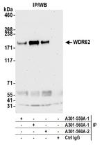 WDR62 Antibody in Immunoprecipitation (IP)