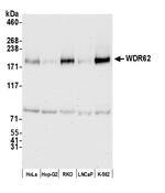 WDR62 Polyclonal Antibody