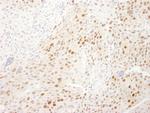 WDR77/MEP50 Polyclonal Antibody