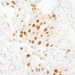 WDR77/MEP50 Polyclonal Antibody